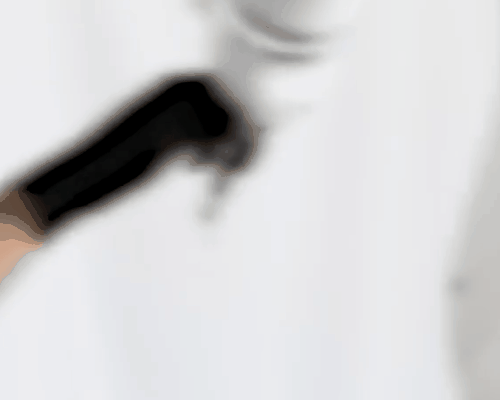 Neocis Yomi S Surgical Robot